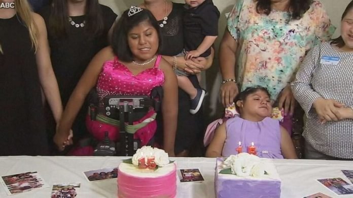 A szétválasztott sziámi ikrek nemrég ünnepelték 21. születésnapjukat: az orvosok nem sok esélyt adtak nekik a túlélésre