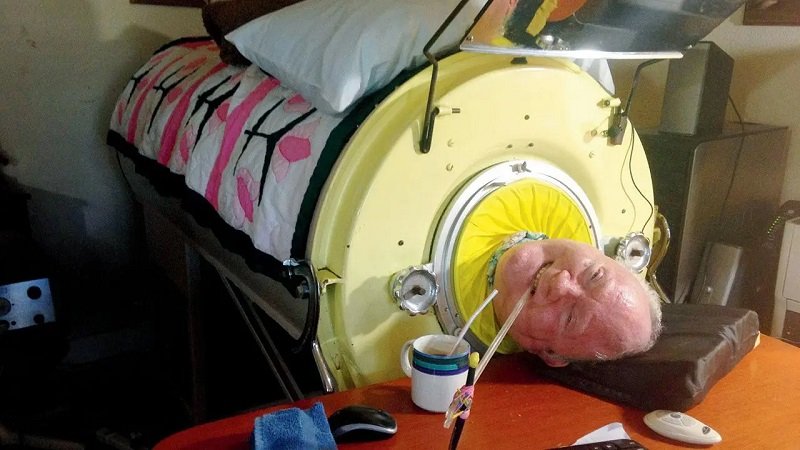 Paul Alexander megrázó története: 71 éve él egy „vastüdőben”