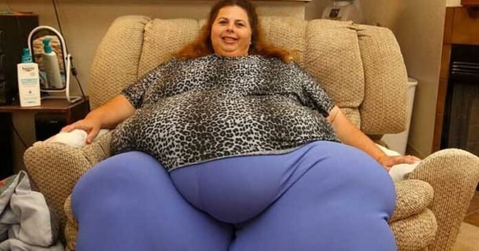 Ő volt a világ legkövérebb nője, ma már felismerhetetlen, miután 250 kilót fogyott
